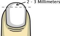 Móng nhô lên so với phần da thịt đầu ngón tay tầm 2-3mm